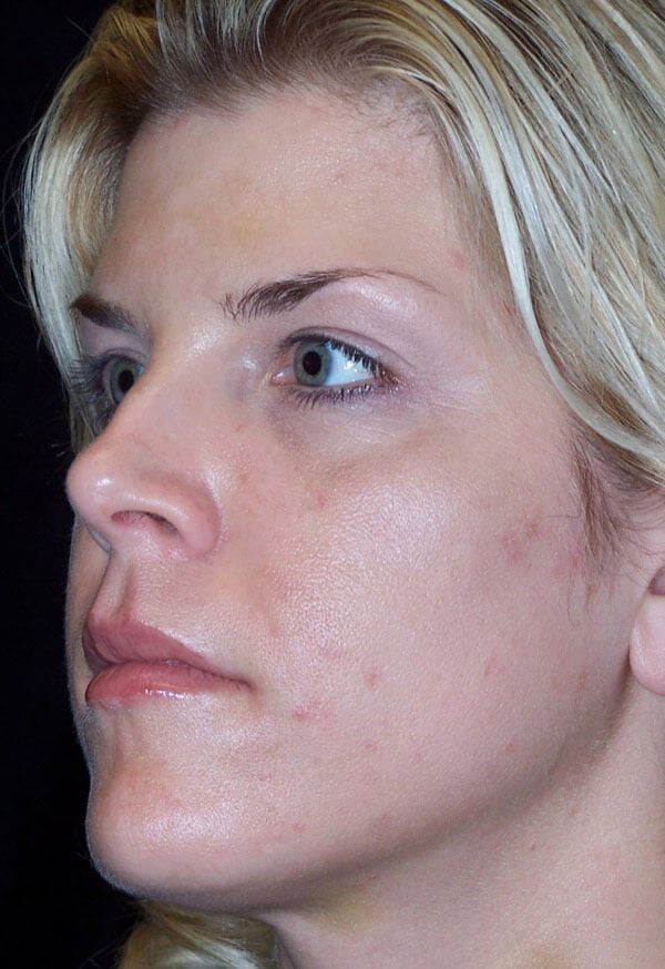 Woman's facial profile before