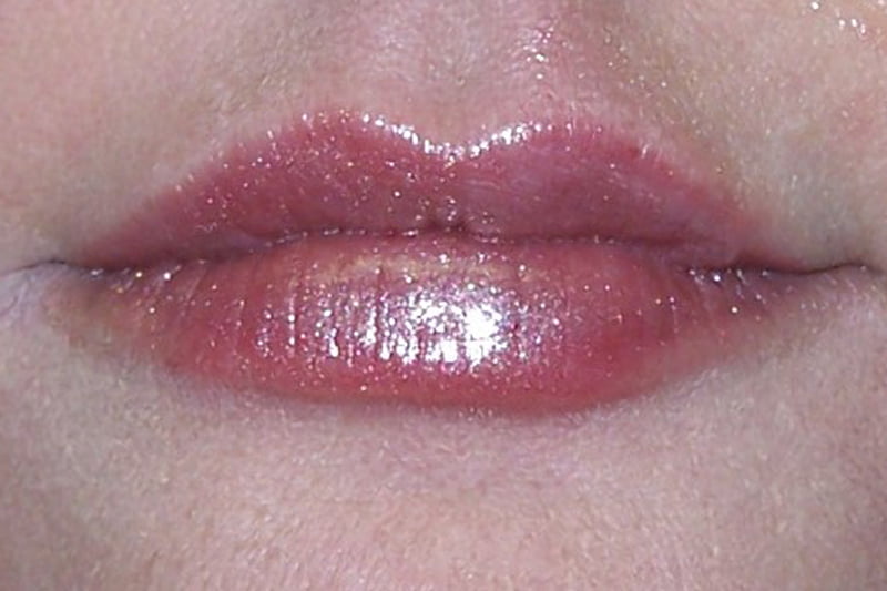 close up of lips after filler