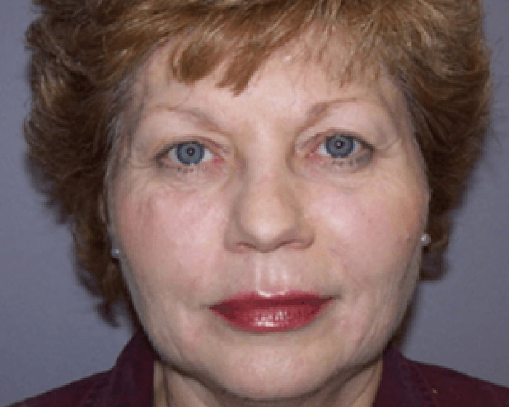 woman after treatment