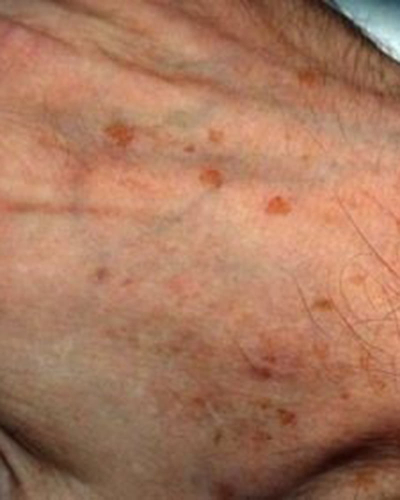 close up of hand with sun spots