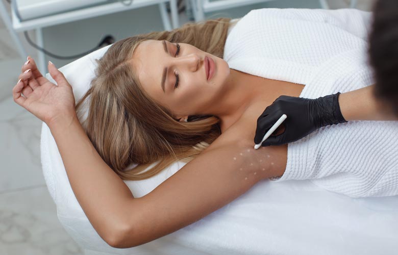 woman receiving hyperhidrosis treatment