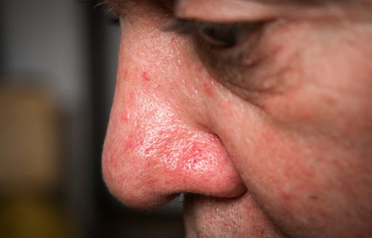 close up of woman's face