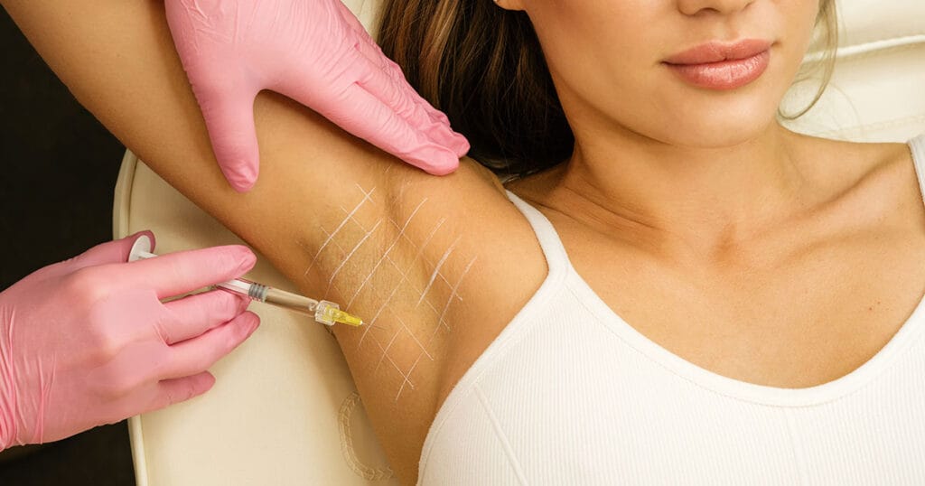 Botox for Hyperhidrosis